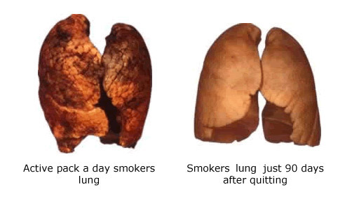 before-and-after-quitting-smoking